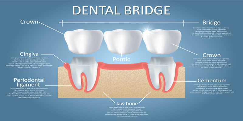 Single Product 3D preview SA