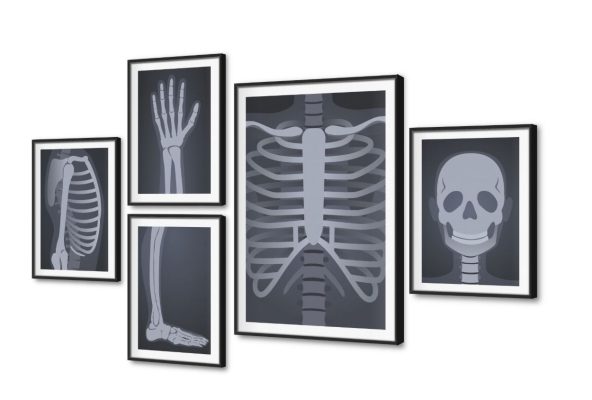 تابلوه مودرن كانفاس أشعة لهيكل عظمي SA108981 كل التابلوهات المودرن, اعمال و شركات, عيادات - طبيه - مستشفيات ابيض و اسود, الوان داكنة, رمادى الستريشن - فيكتور, بسيط و هادئ, مودرن مكاتب – شركات - اعمال بالعرض, ببرواز, برواز SF9, برواز اسود, مستطيل